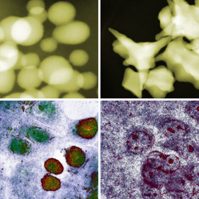 Nanocząstki złota zabijają nowotwory – ale nie tak, jak myślano